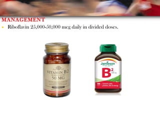 MANAGEMENT
• Riboflavin 25,000-50,000 mcg daily in divided doses.
 
