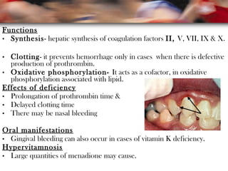 Functions
• Synthesis- hepatic synthesis of coagulation factors II, V, VII, IX & X.
• Clotting- it prevents hemorrhage only in cases when there is defective
production of prothrombin.
• Oxidative phosphorylation- It acts as a cofactor, in oxidative
phosphorylation associated with lipid.
Effects of deficiency
• Prolongation of prothrombin time &
• Delayed clotting time
• There may be nasal bleeding
Oral manifestations
• Gingival bleeding can also occur in cases of vitamin K deficiency.
Hypervitamnosis
• Large quantities of menadione may cause.
 