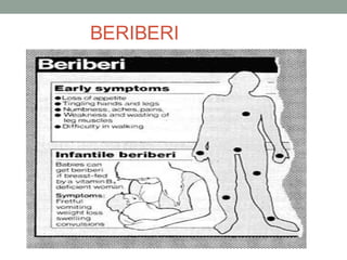 BERIBERI
 