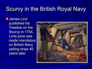 SSccuurrvvyy iinn tthhee BBrriittiisshh RRooyyaall NNaavvyy 
JJaammeess LLiinndd 
ppuubblliisshheedd hhiiss 
TTrreeaattiissee oonn tthhee 
SSccuurrvvyy iinn 11775544.. 
LLiimmee jjuuiiccee wwaass 
mmaaddee mmaannddaattoorryy 
oonn BBrriittiisshh NNaavvyy 
ssaaiilliinngg sshhiippss 4400 
yyeeaarrss llaatteerr 
 