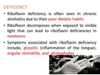 • Riboflavin deficiency is often seen in chronic
alcoholics due to their poor dietetic habits
• Riboflavin decomposes when exposed to visible
light that can lead to riboflavin deficiencies in
newborns
• Symptoms associated with riboflavin deficiency
include, glossitis (inflammation of the tongue),
angular stomatitis, and photophobia
 