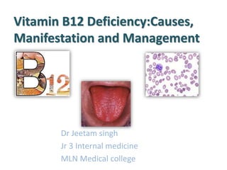 Vitamin B12 Deficiency:Causes,
Manifestation and Management
Dr Jeetam singh
Jr 3 Internal medicine
MLN Medical college
 
