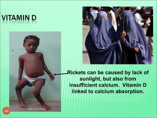 48
Rickets can be caused by lack of
sunlight, but also from
insufficient calcium. Vitamin D
linked to calcium absorption.
 