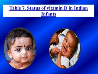 Table 7. Status of vitamin D in Indian
Infants
31
 