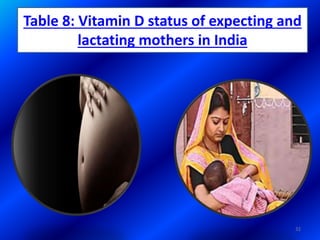 Table 8: Vitamin D status of expecting and
lactating mothers in India
32
 