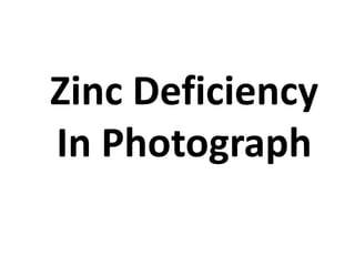 Zinc Deficiency
In Photograph
 