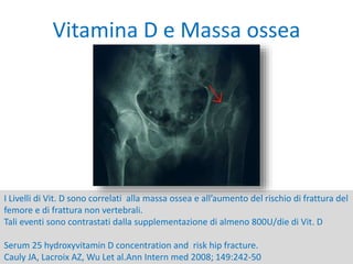 I Livelli di Vit. D sono correlati alla massa ossea e all’aumento del rischio di frattura del
femore e di frattura non vertebrali.
Tali eventi sono contrastati dalla supplementazione di almeno 800U/die di Vit. D
Serum 25 hydroxyvitamin D concentration and risk hip fracture.
Cauly JA, Lacroix AZ, Wu Let al.Ann Intern med 2008; 149:242-50
Vitamina D e Massa ossea
 