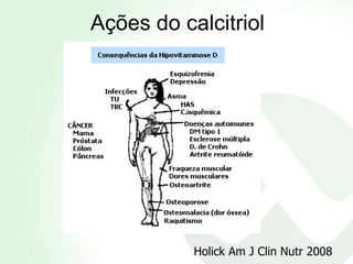 Ações do calcitriol




           Holick Am J Clin Nutr 2008
 