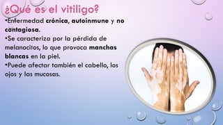 ¿Qué es el vitiligo?
•Enfermedad crónica, autoinmune y no
contagiosa.
•Se caracteriza por la pérdida de
melanocitos, lo que provoca manchas
blancas en la piel.
•Puede afectar también el cabello, los
ojos y las mucosas.
 