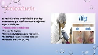 El vitiligo no tiene cura definitiva, pero hay
tratamientos que pueden ayudar a mejorar el
aspecto de la piel:
•Corticoides tópicos
•Inmunomoduladores (como tacrolimus)
•Fototerapia (UVB de banda estrecha)
•Psoraleno más UVA (PUVA)
 