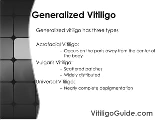Causes of Vitiligo Inheritance ( 30% of vitiligo affected people inherit this skin disorder ) Severe mental or physical trauma Other autoimmune diseases VitiligoGuide.com 