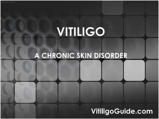VITILIGO A CHRONIC SKIN DISORDER VitiligoGuide.com 