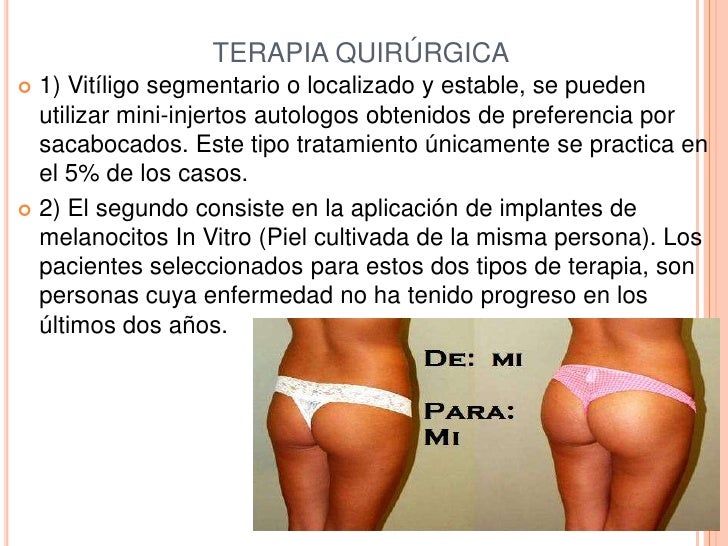 La gimnasia de la persona de las arrugas de la foto antes y después