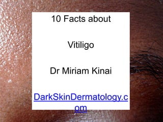 10 Facts about

       Vitiligo

   Dr Miriam Kinai

DarkSkinDermatology.c
         om
 