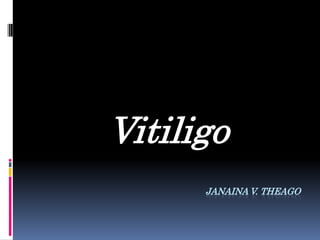 Vitiligo
      JANAINA V. THEAGO
 