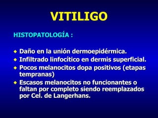 VITILIGO HISTOPATOLOGÍA : Daño en la unión dermoepidérmica. Infiltrado linfocítico en dermis superficial. Pocos melanocitos dopa positivos (etapas tempranas) Escasos melanocitos no funcionantes o faltan por completo siendo reemplazados por Cel. de Langerhans. 