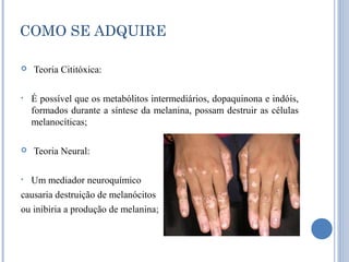 COMO SE ADQUIRE

   Teoria Cititóxica:

•   É possível que os metabólitos intermediários, dopaquinona e indóis,
    formados durante a síntese da melanina, possam destruir as células
    melanocíticas;

   Teoria Neural:

• Um mediador neuroquímico
causaria destruição de melanócitos
ou inibiria a produção de melanina;
 