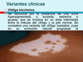 Variantes clínicas
 Vitiligo tricrómico.
 Se reconoce por la presencia de una zona
hiperpigmentada o azulada, estrecha o
gruesa, que se localiza en un área intermedia
entre la mácula del vitíligo y la piel normal. Se
considera una variante del vitíligo inestable, pues
en su evolución natural progresaa la
despigmentación total.
 