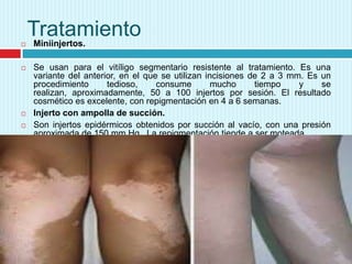 






Tratamiento
Miniinjertos.
Se usan para el vitíligo segmentario resistente al tratamiento. Es una
variante del anterior, en el que se utilizan incisiones de 2 a 3 mm. Es un
procedimiento
tedioso,
consume
mucho
tiempo
y
se
realizan, aproximadamente, 50 a 100 injertos por sesión. El resultado
cosmético es excelente, con repigmentación en 4 a 6 semanas.
Injerto con ampolla de succión.
Son injertos epidérmicos obtenidos por succión al vacío, con una presión
aproximada de 150 mm Hg. La repigmentación tiende a ser moteada.

 