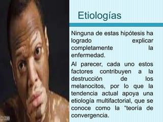 Etiologías




Ninguna de estas hipótesis ha
logrado
explicar
completamente
la
enfermedad.
Al parecer, cada uno estos
factores contribuyen a la
destrucción
de
los
melanocitos, por lo que la
tendencia actual apoya una
etiología multifactorial, que se
conoce como la “teoría de
convergencia.

 