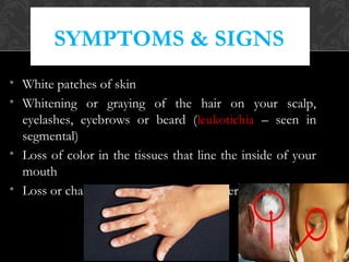 SYMPTOMS & SIGNS
• White patches of skin
• Whitening or graying of the hair on your scalp,
eyelashes, eyebrows or beard (leukotichia – seen in
segmental)
• Loss of color in the tissues that line the inside of your
mouth
• Loss or change in color of the inner layer of your eye
 