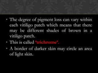 • The degree of pigment loss can vary within
each vitiligo patch which means that there
may be different shades of brown in a
vitiligo patch.
• This is called ‘trichrome’.
• A border of darker skin may circle an area
of light skin.
 