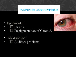 SYSTEMIC ASSOCIATIONS
• Eye disorders
•  Uvietis
•  Depigmentation of Choroid.
• Ear disorders
•  Auditory problems
 