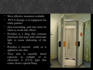 • Most effective treatment available
• PUVA therapy is to repigment the
white patches
• time-consuming, and care must be
taken to avoid side effects
• Psoralen is a drug that contains
chemicals that react with ultraviolet
light to cause darkening of the
skin.
• Psoralen is injected orally or is
applied to the skin
• Then skin is carefully timed
exposure to sunlight or to
ultraviolet A (UVA) light that
comes from a special lamp.
 