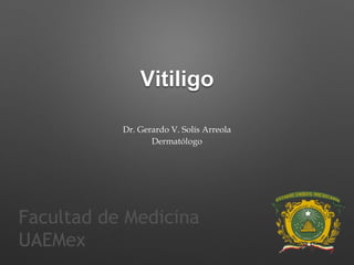 Vitiligo 
Dr. Gerardo V. Solís Arreola 
Dermatólogo 
Facultad de Medicina 
UAEMex 
 