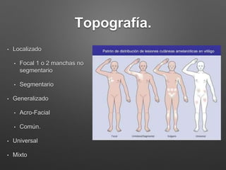Topografía. 
• Localizado 
• Focal 1 o 2 manchas no 
segmentario 
• Segmentario 
• Generalizado 
• Acro-Facial 
• Común. 
• Universal 
• Mixto 
 