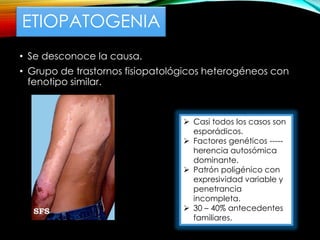 ETIOPATOGENIA
• Se desconoce la causa.
• Grupo de trastornos fisiopatológicos heterogéneos con
fenotipo similar.
 Casi todos los casos son
esporádicos.
 Factores genéticos -----
herencia autosómica
dominante.
 Patrón poligénico con
expresividad variable y
penetrancia
incompleta.
 30 – 40% antecedentes
familiares.
 
