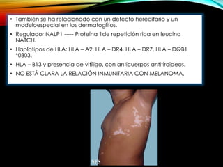 • También se ha relacionado con un defecto hereditario y un
modeloespecial en los dermatoglifos.
• Regulador NALP1 ----- Proteína 1de repetición rica en leucina
NATCH.
• Haplotipos de HLA: HLA – A2, HLA – DR4, HLA – DR7, HLA – DQB1
*0303.
• HLA – B13 y presencia de vitíligo, con anticuerpos antitiroideos.
• NO ESTÁ CLARA LA RELACIÓN INMUNITARIA CON MELANOMA.
 