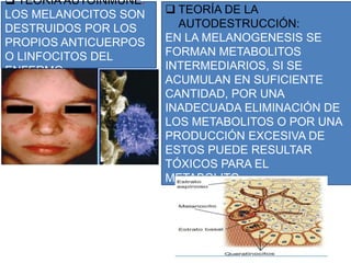  TEORÍA AUTOINMUNE:
LOS MELANOCITOS SON
DESTRUIDOS POR LOS
PROPIOS ANTICUERPOS
O LINFOCITOS DEL
ENFERMO
 TEORÍA DE LA
AUTODESTRUCCIÓN:
EN LA MELANOGENESIS SE
FORMAN METABOLITOS
INTERMEDIARIOS, SI SE
ACUMULAN EN SUFICIENTE
CANTIDAD, POR UNA
INADECUADA ELIMINACIÓN DE
LOS METABOLITOS O POR UNA
PRODUCCIÓN EXCESIVA DE
ESTOS PUEDE RESULTAR
TÓXICOS PARA EL
METABOLITO.
 
