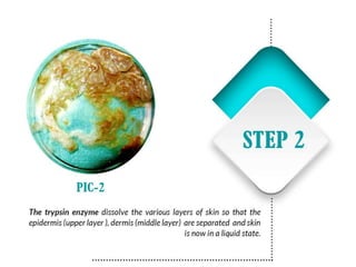 Vitiligo and It's Treatment