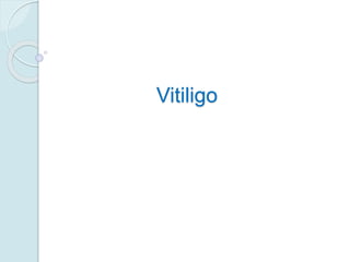 Vitiligo
 