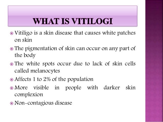 Vitiligo : causes, symptoms, diagnosis and treatment