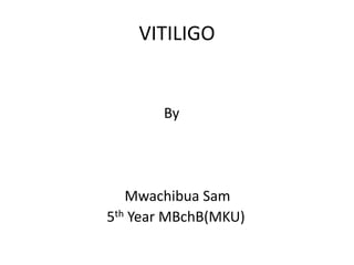 VITILIGO
By
Mwachibua Sam
5th Year MBchB(MKU)
 