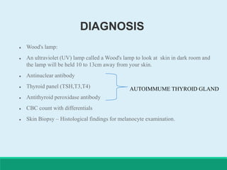 DIAGNOSIS
 Wood's lamp:
 An ultraviolet (UV) lamp called a Wood's lamp to look at skin in dark room and
the lamp will be held 10 to 13cm away from your skin.
 Antinuclear antibody
 Thyroid panel (TSH,T3,T4)
 Antithyroid peroxidase antibody
 CBC count with differentials
 Skin Biopsy – Histological findings for melanocyte examination.
AUTOIMMUME THYROID GLAND
 