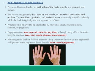  Non– Segmental vitiligo(bilateral):
 Pigmented lesions develop on both sides of the body, usually in a symmetrical
pattern.
 The lesions are generally first seen on the hands, at the wrists, body folds and
orifices. The umbilicus, genitalia, and perianal areas are usually also affected early,
while the back is typically the last region to be affected.
 Progression is believed to be aggravated by emotional shock, physical illness,
sunburn, or pregnancy.
 Depigmentation may stop and restart at any time, although rarely affects the entire
body. In addition, areas may regain pigment spontaneously.
 Melanocytes in the hair follicles are more likely to survive in cases of non-segmental
vitiligo than in the segmental form, thus the hairs remain pigmented.
 