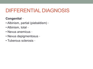DIFFERENTIAL DIAGNOSIS
•
Congenital
•
• Albinism, partial (piebaldism)
•
• Albinism, total
•
• Nevus anemicus
•
• Nevus depigmentosus
•
• Tuberous sclerosis
 