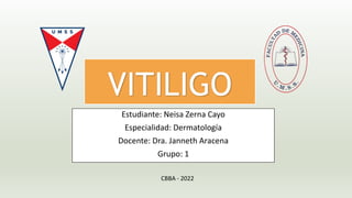 VITILIGO
Estudiante: Neisa Zerna Cayo
Especialidad: Dermatología
Docente: Dra. Janneth Aracena
Grupo: 1
CBBA - 2022
 