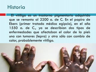 Historia
El vitíligo es un trastorno pigmentario adquirido
que se remonta al 2200 a. de C. En el papiro de
Ebers (primer tratado médico egipcio), en el año
1550 a. de C., ya se describían dos tipos de
enfermedades que afectaban el color de la piel:
una con tumores (lepra) y otra sólo con cambio de
color, probablemente vitíligo.
 