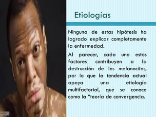 Etiologías
 Ninguna de estas hipótesis ha
logrado explicar completamente
la enfermedad.
 Al parecer, cada uno estos
factores contribuyen a la
destrucción de los melanocitos,
por lo que la tendencia actual
apoya una etiología
multifactorial, que se conoce
como la “teoría de convergencia.
 
