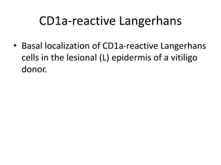 CD1a-reactive Langerhans
• Basal localization of CD1a-reactive Langerhans
cells in the lesional (L) epidermis of a vitiligo
donor.
 