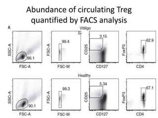 Abundance of circulating Treg
quantified by FACS analysis
 