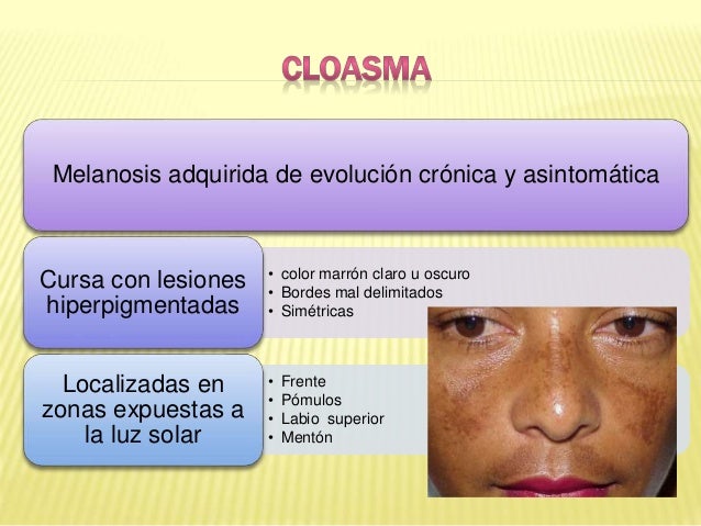 Enrojece la persona de las manchas de pigmento