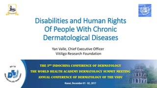 Disabilities and Human Rights
Of People With Chronic
Dermatological Diseases
Yan Valle, Chief Executive Officer
Vitiligo Research Foundation
501(c)3 Non-profit organization
Consultative member of the UN ECOSOC
 
