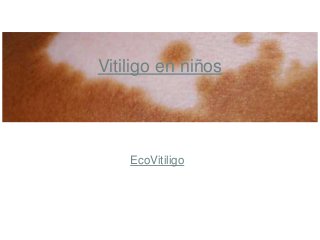 EcoVitiligo
Vitiligo en niños
 