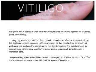 Vitiligo is a skin disorder that causes white patches of skin to appear on different
parts of the body.
Losing pigment in the skin is often called Leucoderma. Common areas include
the body parts most exposed to the sun (such as the hands, face and feet) as
well as areas such as the armpits and the genital region. The patches tend to
spread, sometimes very slowly over a number of years and sometimes in a
matter of days.
Keep reading if you would like to know how to get rid of white spots on face. This
is the same skin disease that Michael Jackson suffered from.

 