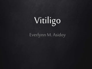 Vitiligo
Everlynn M.Asidoy
 